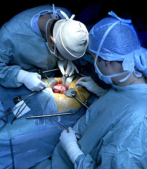 Kidney transplant